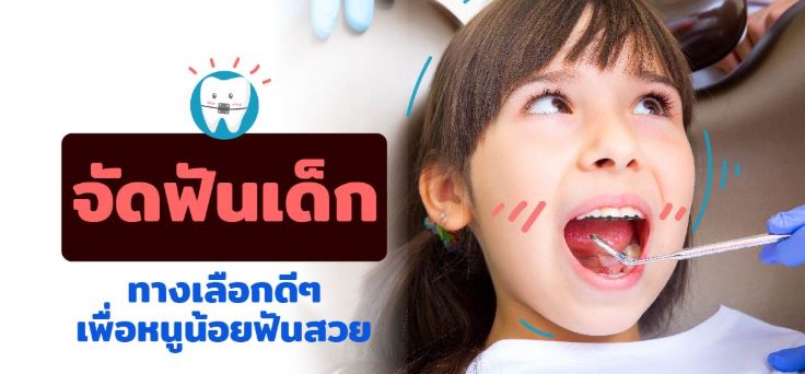 การจัดฟันเด็ก ทางเลือกดีๆเพื่อหนูน้อยฟันสวย