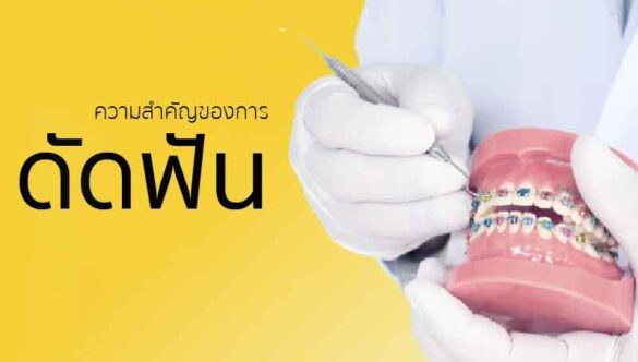 ความสำคัญของการ ดัดฟัน