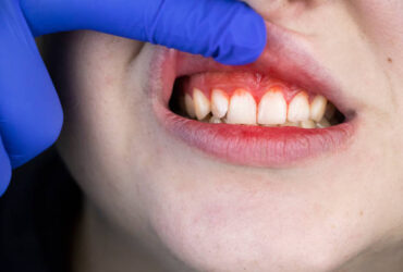 istockphoto-โรงเหงือก1206261613-612x612
