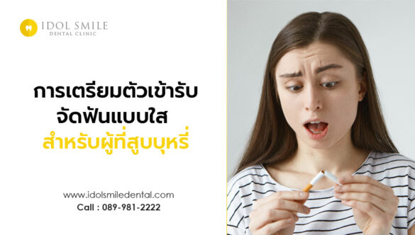 การเตรียมตัวเข้ารับการจัดฟันแบบใส สำหรับผู้ที่สูบบุหรี่