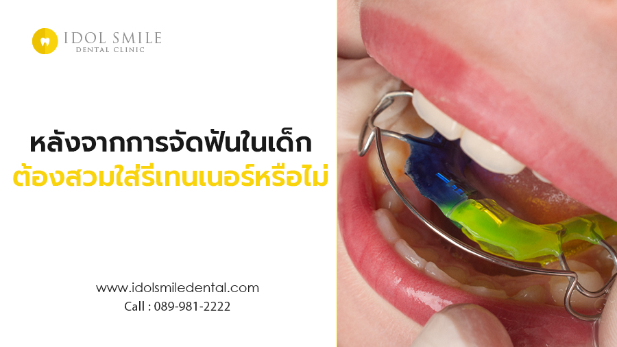 หลังจากการจัดฟันในเด็ก ต้องสวมใส่รีเทนเนอร์หรือไม่