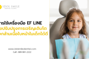 การใช้เครื่องมือ EF LINE ช่วยปรับปรุงการเจริญเติบโตของกล้ามเนื้อใบหน้าในเด็กได้ดี