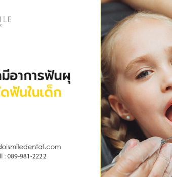 หากเด็กมีอาการฟันผุ ขณะจัดฟันในเด็ก
