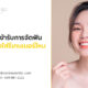 หลังจากเข้ารับการจัดฟันแบบใส ต้องใส่รีเทนเนอร์ไหม