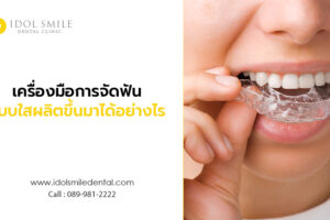 เครื่องมือการจัดฟันแบบใส ผลิตขึ้นมาได้อย่างไร